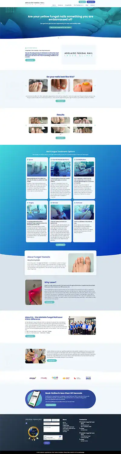 Modern clinic offering fungal nail laser treatment in Adelaide, expert podiatrists.